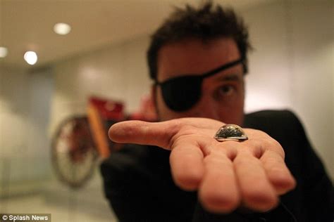 Canadian Man Rob Spence Replaces His Glass Eyeball With A Camera