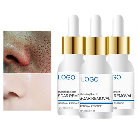 2021 New Acne Scar Removal Serum Cream Face Care Dark Spot Removing