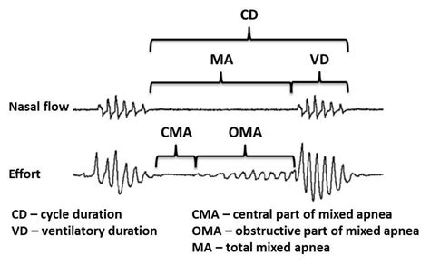 mixed apnea metrics  diagnostic polysomnographies  obstructive