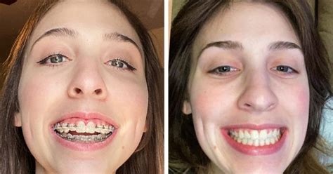 12 Dental Transformations That Blew Us Away
