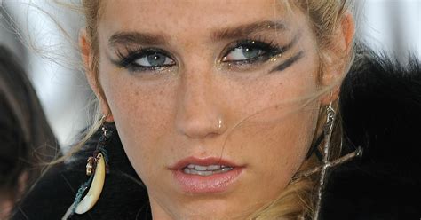 Kesha Drops Sexual Abuse Lawsuit Against Dr Luke Daily