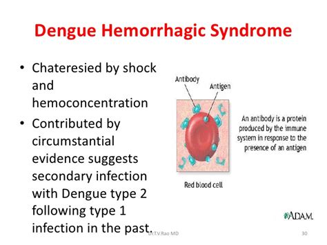 Dengue Fever Update