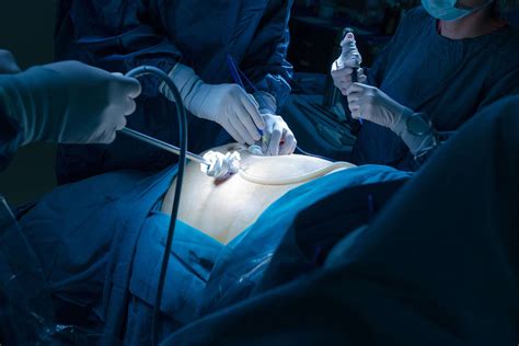 hiatal hernia surgery   expect   day  surgery