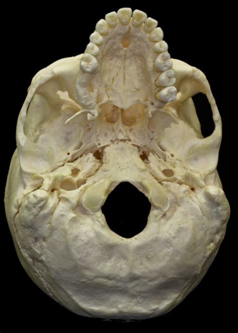 Inferior View Of Bony Skull Neuroanatomy The Neurosurgical Atlas