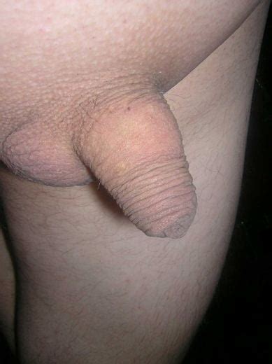 Soft And Small Uncut Cocks 2 300 Pics 4 Xhamster