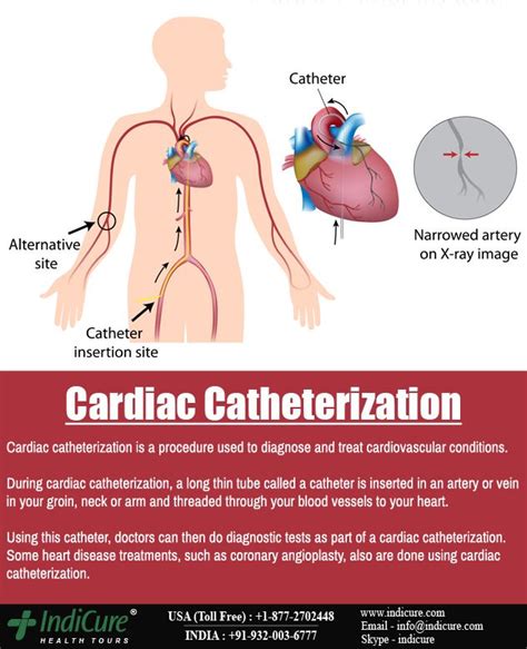 cardiac catheterization is a medical procedure that cardiologists or