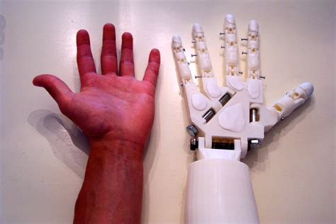 diy prosthetic hand forearm voice controlled  steps