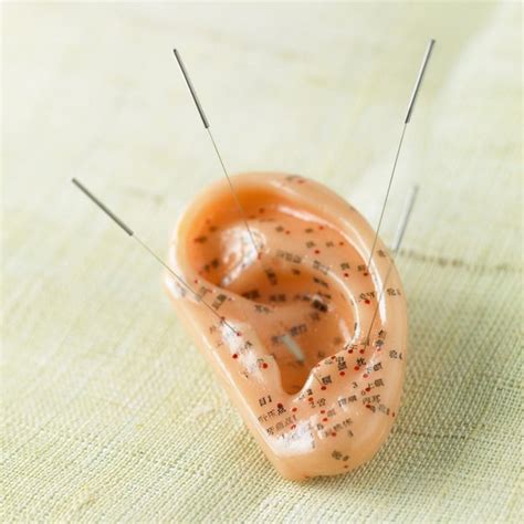 acupuncture for clogged ears