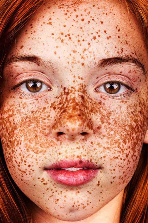 Amazing Portraits That Prove Freckles Are Beautiful