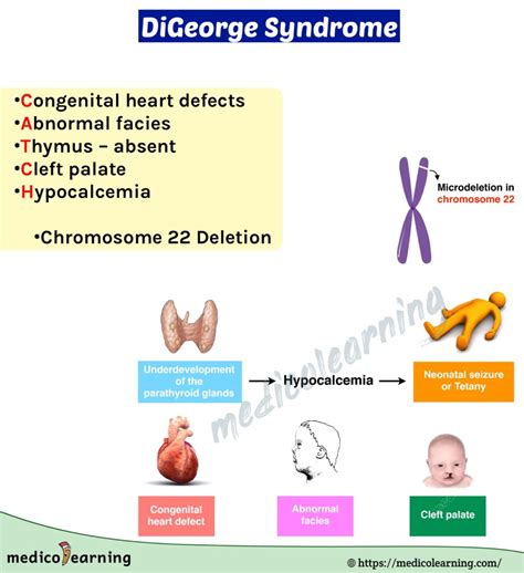 digeorge syndrome medicolearning