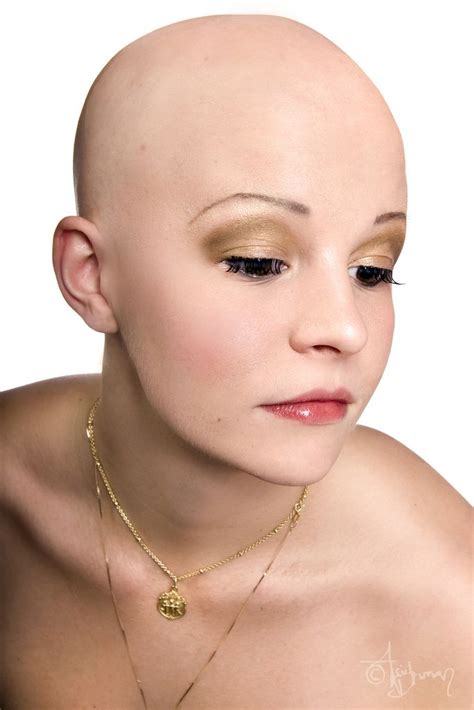 don t be afraid to sing bald women hair loss women balding remedies