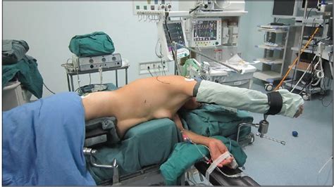 Esophageal Suspension Method In Scavenging Peripheral