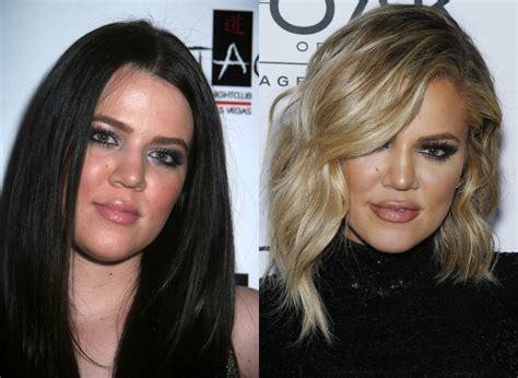 Celebrity Plastic Surgery 30 Before And After Photos