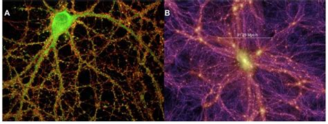 one of these pictures is the brain the other is the universe can you