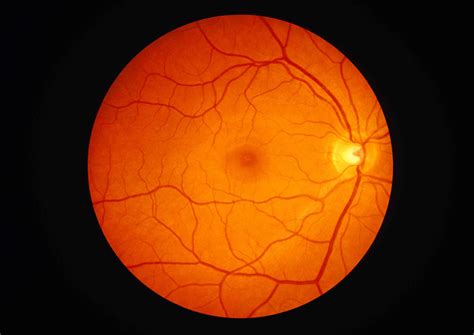 la anatomia de la retina medicina basica