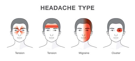 types  headaches scoopify
