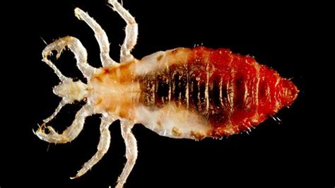 professor says canberra head lice have become resistant to treatment