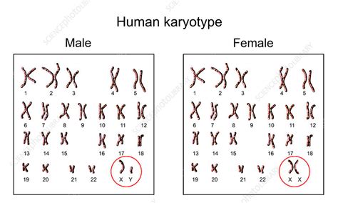 Human Chromosomes Male Vs Female Karyotype Illustration