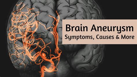 brain aneurysm  unusual symptoms   condition   lead
