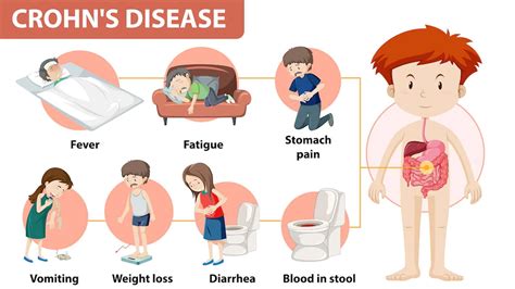 crohns disease  symptoms diagnosis  treatment
