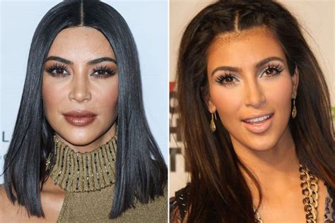 Kim Kardashian S Plastic Surgery Timeline In Full As Star