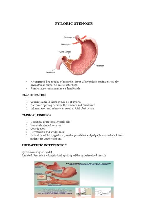 bowel disorder peptic ulcer constipation