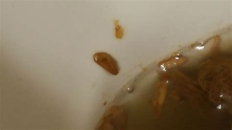 please help to identify the parasites exiting my body from