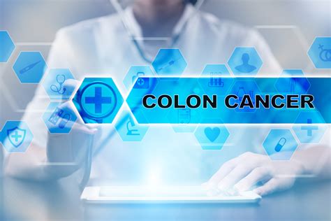 Treatments For Colon Cancer Based On The Stage Facty Health