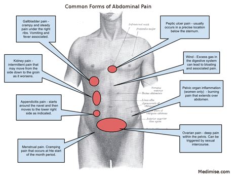 abdominal pain stomach ache   treatments medimise