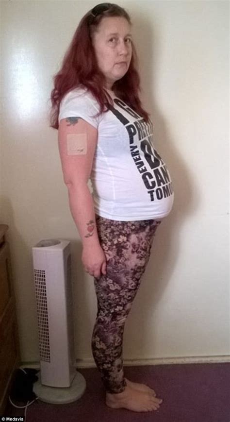 woman who looks pregnant is diagnosed with a life threatening