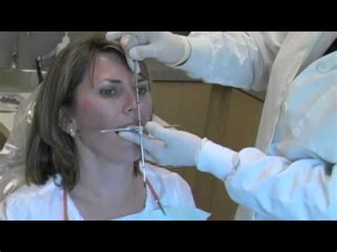 Kois dental facial analyzer