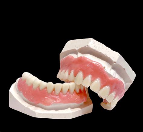 Diy Kit Denture Resin Teeth Upper And Lower Best Denture Kit Etsy