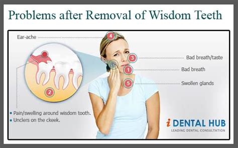 problems after removal of wisdom teeth wisdom teeth removal impacted wisdom teeth wisdom teeth
