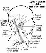 Lymph Neck Nodes Head Gland Swollen Glands Parotid Lymphatic Node Drainage Health System Diagram Pain Swelling Cervical Remedies Chronic Illness sketch template