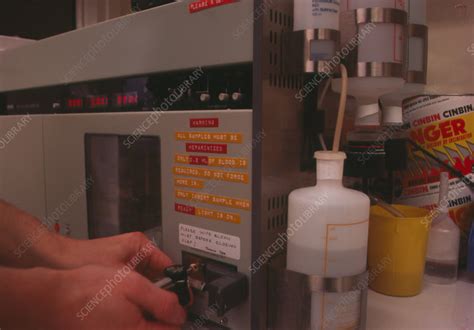 blood gas analysis stock image  science photo library