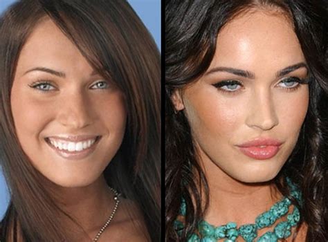 megan fox plastic surgery before after