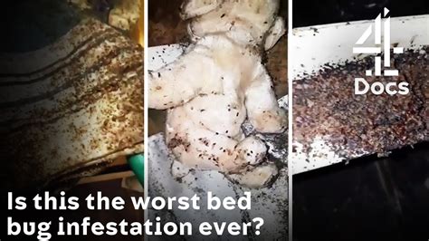 Horrific Bed Bug Infestation In Apartment Block Worst