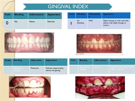 gingival indexs
