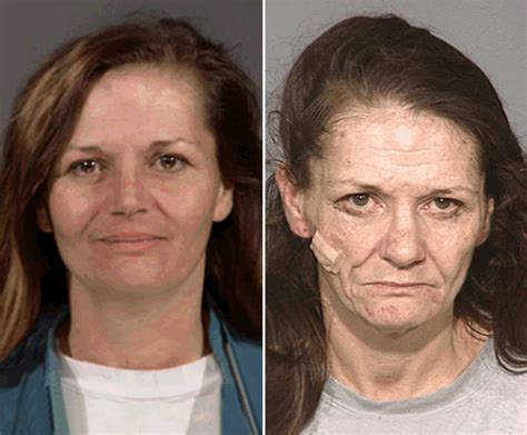These Are The Devastating Faces Of Crystal Meth Addiction