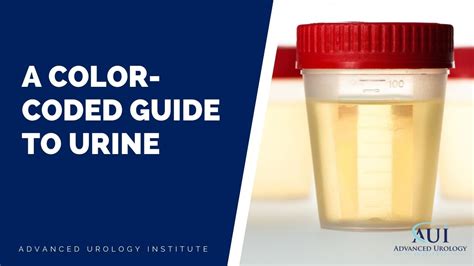 color coded guide  urine advanced urology institute