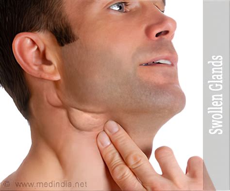 swollen lymph nodes  neck  ovulation