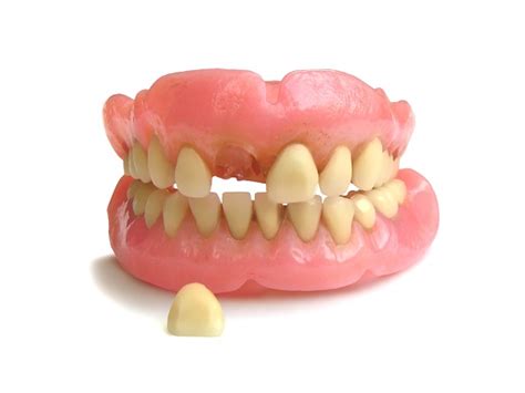 options  replacing  missing tooth landmark dental care nashua  hampshire