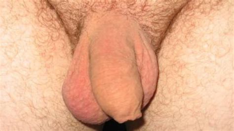 Soft And Small Uncut Cocks 301 Pics Xhamster