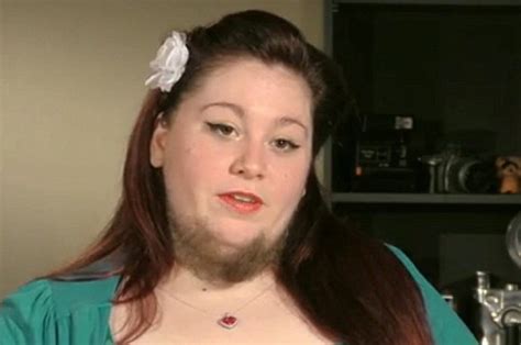 bearded lady grows facial fuzz as husband loves her anyway