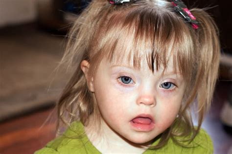 17 best images about down syndrome on pinterest down