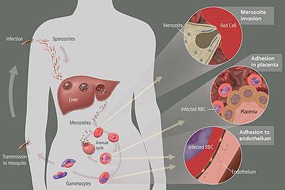 malaria  curezone image gallery