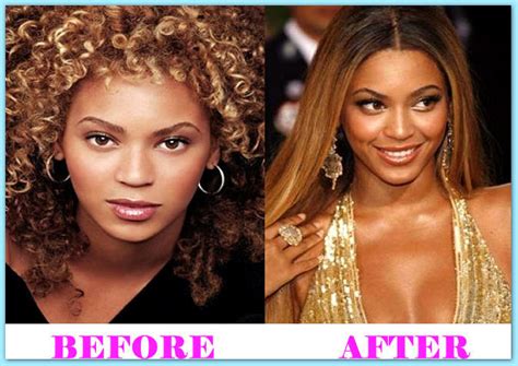 Beyonce Plastic Surgery Before And After Plastic Surgery