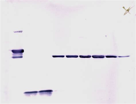 western blot wikidoc