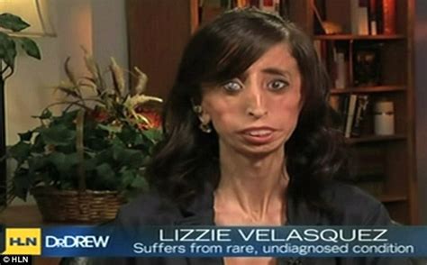 world s ugliest woman lizzie velasquez gives courageous interview