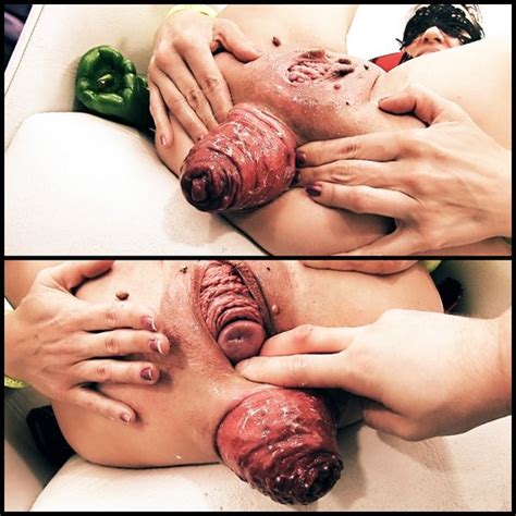 brutal fist fucking anal vaginal fisting and insertions collection page 88